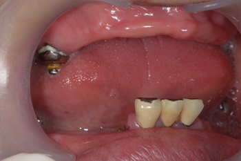 症例 スター歯科クリニック