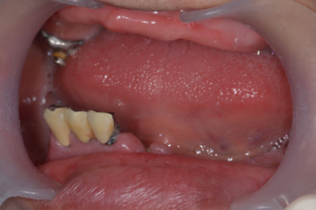 症例 スター歯科クリニック